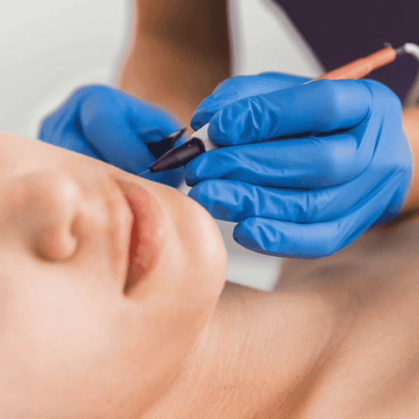 Electrolysis Hair Removal: Benefits, Side Effects & What to&nbsp;Expect