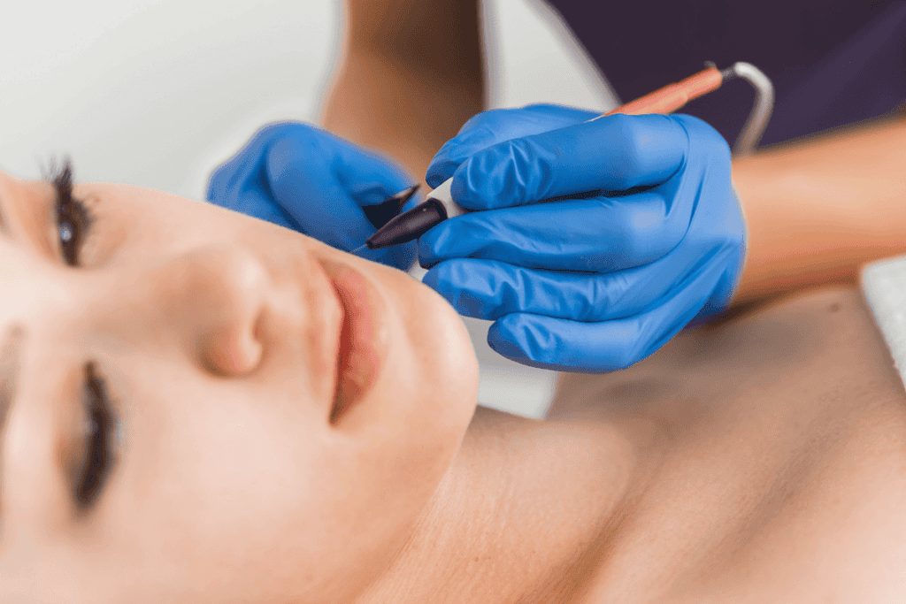 Electrolysis Hair Removal: Benefits, Side Effects & What to&nbsp;Expect
